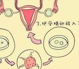 哈医大一院巧囊试管怎么样？哪些方面要注意？