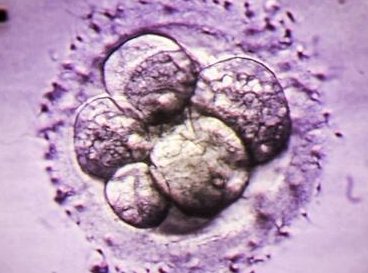 跳绳可以激活卵巢功能吗？跳绳对卵巢好吗？